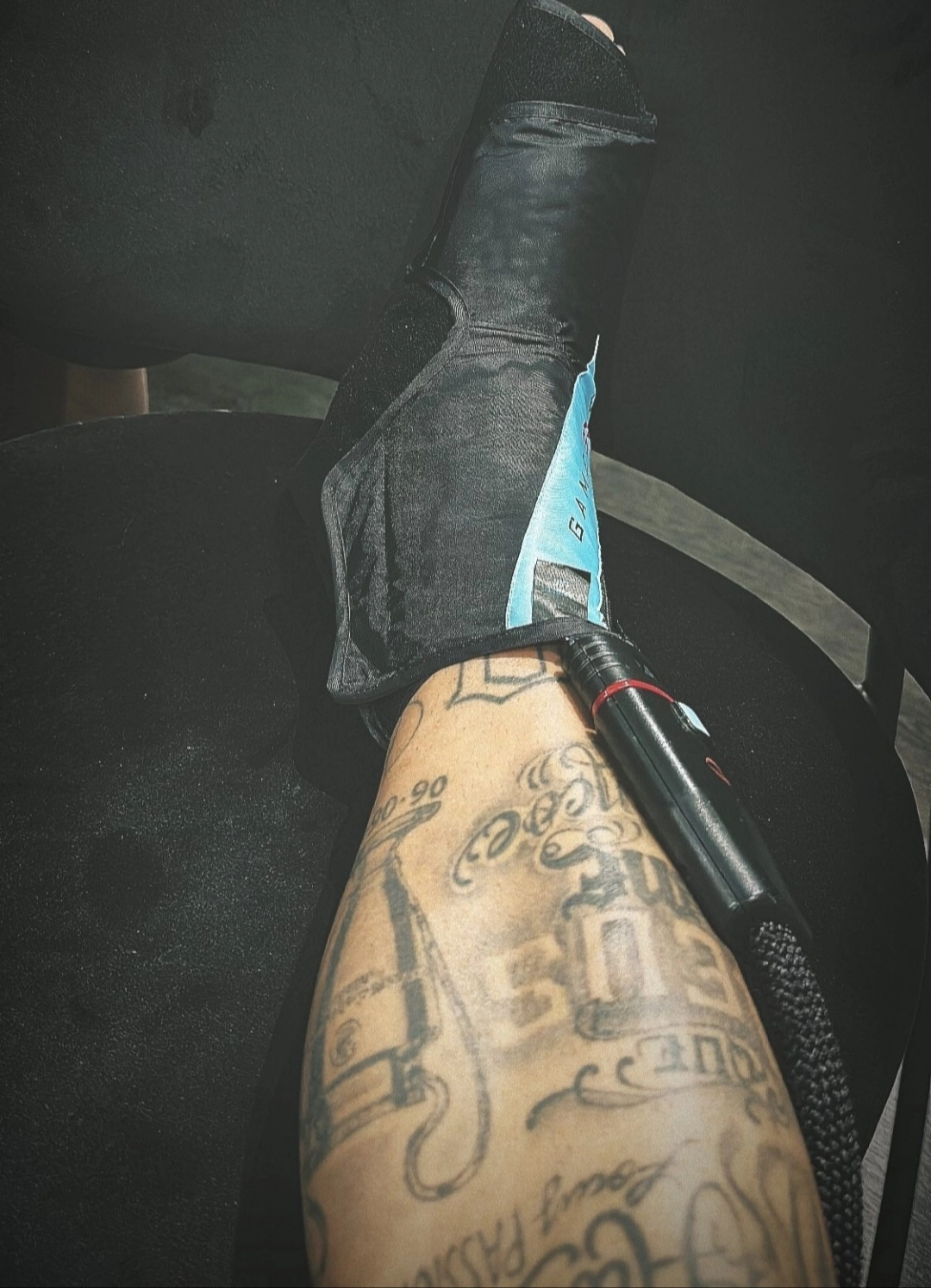 Neymar zədəli ayağının fotosunu yaydı