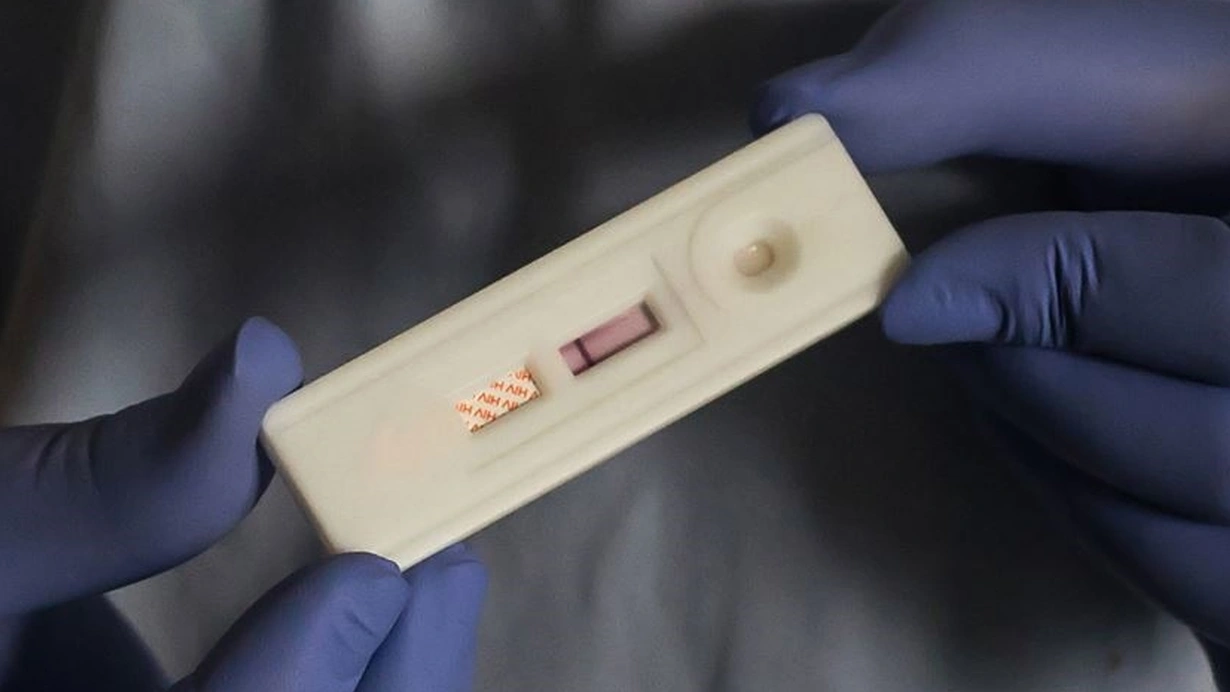 2023-cü ildə Banqladeşdə 34 ilin ən yüksək İİV hadisəsi aşkar edilib