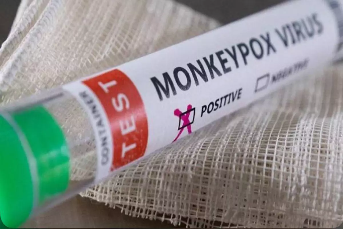 Bu ərazidə fövqəladə vəziyyət ELAN EDİLDİ