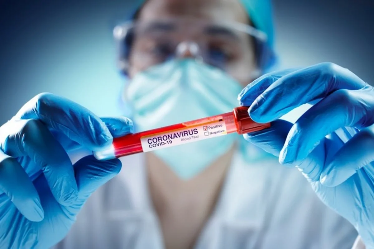 Bu tibb işçilərinin maaş əlavələrinin müddəti uzadıldı