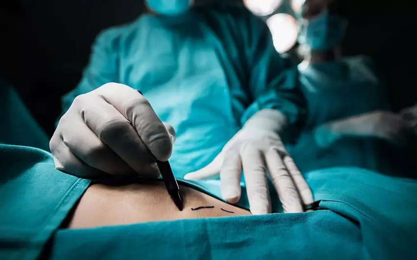 Nazir: Plastik cərrahların fəaliyyətinin yoxlanılması gələn ay başa çatır